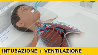 Intubazione Endotracheale e Ventilazione Meccanica in 3D [upl. by Barry]