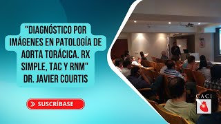 Jornada de Docencia quotDiagnóstico por imágenes en patología de Aorta Torácica Rx Simple TAC y RNMquot [upl. by Moth]