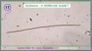 Pond water under Microscope  Oscillatoria Worm like Filament Algae [upl. by Olrak]