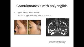 ANCA Vasculitis A Rheumatologists Perspective by Padmapriya Sivaraman MD [upl. by Alik]