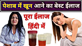 पेशाब में खून आने का बेस्ट ईलाज  Hematuria allopathic treatment  Blood in urine [upl. by Grof]