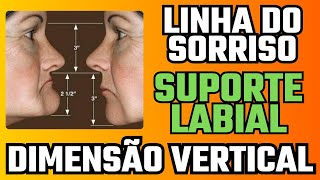 Prótese Fixa e a Dimensão Vertical Linha do Sorriso e Suporte Labial Planejamento  Aula 2 [upl. by Enelehcim693]