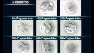 Classification des embryons FIV par leur degré de fragmentation [upl. by Lleneg]