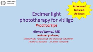 Excimer light phototherapy for vitiligo [upl. by Brie]