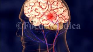 Cerebral angiography  Neuroanatomy [upl. by Ytnom]