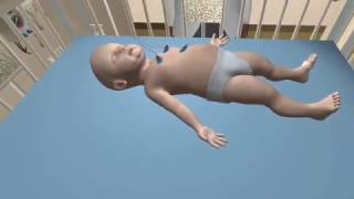 Bronchiolitis Diagnosis Simulation [upl. by Reel]