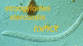 strongyloides stercoralis in Amharic language unit two medical parasitology [upl. by Elaweda967]