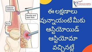 Osteoid Osteoma  causes symptoms and ablation treatment  ఆస్టియోయిడ్ ఆస్టియోమా అధునాతన చికిత్స [upl. by Clotilde57]