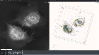 HUVEC cells with gold nanoparticles [upl. by Sylvester]