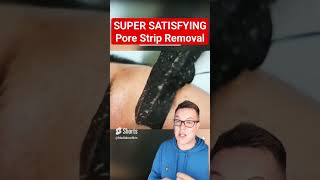 PERFECT PORE STRIP REMOVAL  This Is So Satisfying shorts [upl. by Matthaus]