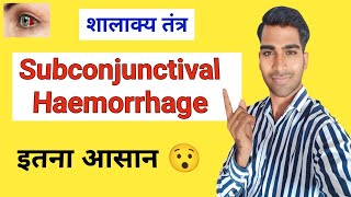 Subconjunctival Hemorrhage In Hindi  Shalakya Tantra  BAMS  AIAPGET  Easy Simple Tricks [upl. by Htebirol]