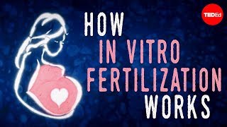 How in vitro fertilization IVF works  Nassim Assefi and Brian A Levine [upl. by Retha94]