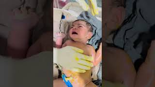 Muconium Aspiration syndrome baby trending beautiful babycare beautiful babycare cutebaby [upl. by Etnauq119]