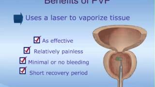 Photoselective Vaporization of the Prostate PVP Laser Therapy for BPH [upl. by Rubie]