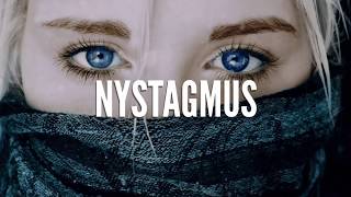 Nystagmus How Do We See It [upl. by Sebastiano]