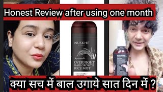 Nuskhe by paras 7 दिन मे बाल उगाये Overnight Hair growth rice mist review after using one month [upl. by Liag]