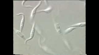 Trypanosoma [upl. by Adehsar]