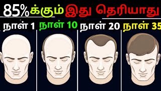 20 வயதினர் Must Watch 🔥🔥 Natural Hairgrowth [upl. by Ashil]