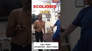 Chiropractic treatment in Udaipur  Scoliosis  Dr Varun Chiropractor  Call now  9313047251 [upl. by Alecia388]