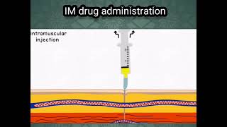 IM Drug Administration  IM Injection doctor foryou unfrezzmyaccount pharmacy shorts viral [upl. by Ardith]