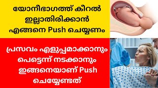 മിനിറ്റുകൾക്കുള്ളിൽ പ്രസവിക്കാൻ ഇങ്ങനെയാണ് Push ചെയ്യേണ്ടത്💯പ്രസവിക്കുന്നതിനു മുന്നേ കണ്ടിരിക്കണം [upl. by Sosanna]