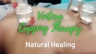 Ventosa Massage  Cupping Therapy Natural Healing Traditional Massage [upl. by Nereids543]