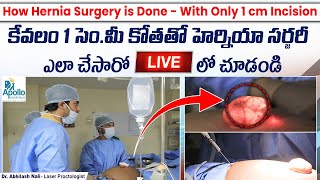 🔴Live🔴  Hernia Surgery in Telugu  How Hernia Surgery is Done With Only a 1 CM Incision  Abhilash [upl. by Imorej941]