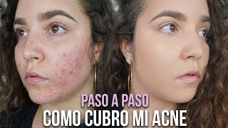 COMO CUBRIR MANCHAS DE ACNE CON MAQUILLAJE  COVER ACNE  Aletsia [upl. by Sreip]