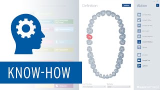 Teleskoptechnik  Step 1 – Tertiärkonstruktion in der Ceramill Mind anlegen [upl. by Weil]