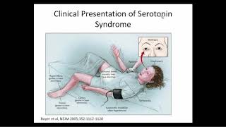 Consult Psychiatry Emergencies A Review of Medication Toxicity Syndromes and Catatonia [upl. by Susejedesoj]