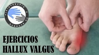 Masaje y ejercicios para juanetes o hallux valgus [upl. by Sadler]