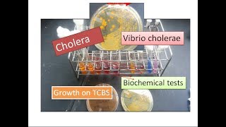 Cholera  Vibrio cholerae [upl. by Carboni398]