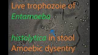 Entamoeba histolytica trophozoite in stool [upl. by Pascal650]