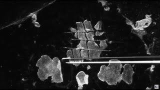 3 Methods for Passaging of Pluripotent Stem Cells [upl. by Luehrmann]