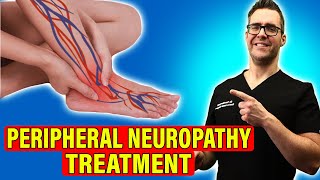 Peripheral Neuropathy Treatment Leg amp Foot Nerve Pain HOME REMEDIES [upl. by Hastie]