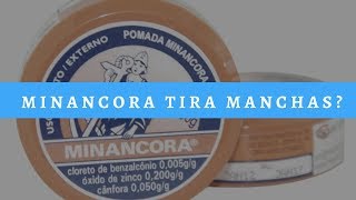 Minancora Tira Manchas  Minancora Clareia a Pele Será [upl. by Adiahs]