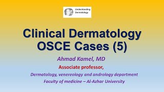 Clinical Dermatology OSCE Cases 5 [upl. by Puttergill]