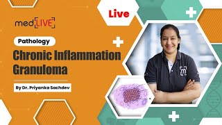 Chronic Inflammation  Granuloma with Dr Priyanka Sachdev [upl. by Eselahs]