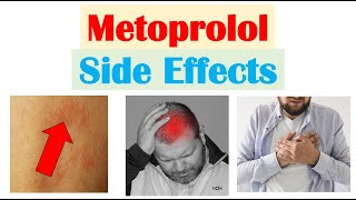 Metoprolol amp Beta Blockers Side Effects amp Why They Occur [upl. by Euqinorev]