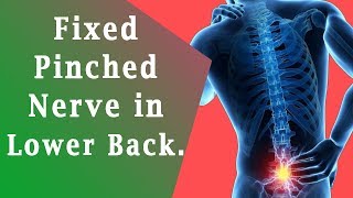 Pinched Nerve in Lower Back  How to Fixed Pinched Nerve in Lower Back [upl. by Plusch268]