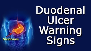 Duodenal Ulcer Warning Signs [upl. by Lancelot]