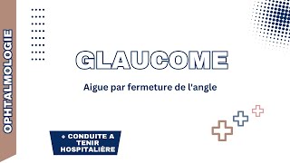 Glaucome aigue par fermeture de langle Rappel physiopathologie formes cliniques DC positif CAT [upl. by Namwen]