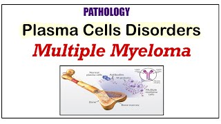 Plasma Cell Disorders  Diagnosis of Multiple Myeloma  Serum Protein Electrophoresis pathology [upl. by Einnaj]