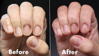 How To Fix DAMAGED THIN amp BRITTLE NAILS NATURAL NAIL STRENGTHENING TREATMENT [upl. by Anivlac406]