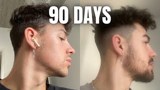 How To GROW A BEARD In 90 Days Using MINOXIDIL amp DERMA ROLLER [upl. by Enilra]