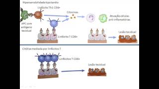 Hipersensibilidades 45 Tipo IV  mediada por linfócitos T [upl. by Ynohtona581]