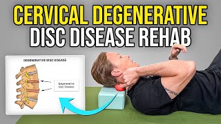 4 Exercises for Cervical Degenerative Disc Disease [upl. by Cosma]