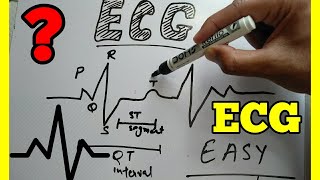 How to Read ECG in Hindi easy wayECG reading in Hindi ECG interpretation make easy ECG [upl. by Oirramaj618]