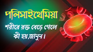 পলিসাইথেমিয়া Polycythaemia  শরীরে রক্ত বেড়ে যাওয়ার রোগ [upl. by Atikan]