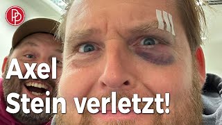 Axel Stein Schauspieler bei Dreh verletzt • PROMIPOOL [upl. by Uol173]